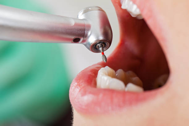 Best Pediatric Emergency Dentist in Midlothian, VA